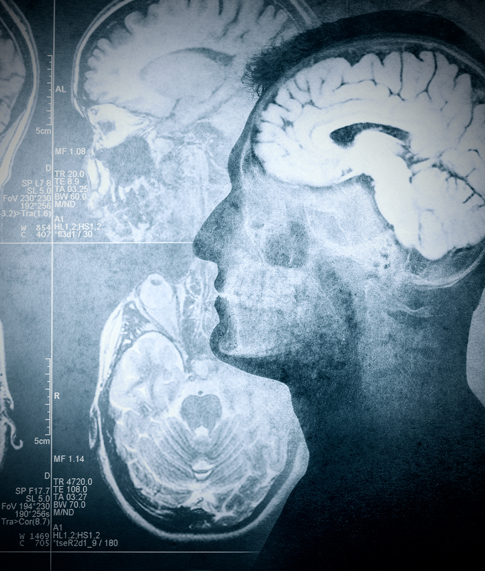 Imagen conceptual en donde aparece la ilustración de un hombre de perfil donde se ve el cerebro y su actividad cerebral 