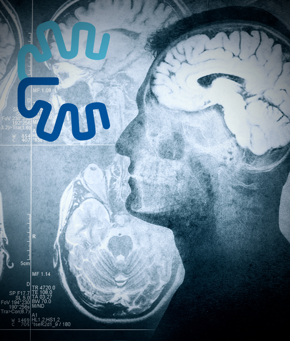 Imagen conceptual en donde aparece la ilustración de un hombre de perfil donde se ve el cerebro y su actividad cerebral 